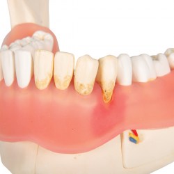 D26_05_1200_1200_Модель-болезней-зубов-3B-Smart-Anatomy
