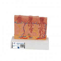 J15_04_1200_1200_Модель-рака-кожи-3B-Smart-Anatomy