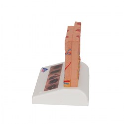 J15_05_1200_1200_Модель-рака-кожи-3B-Smart-Anatomy