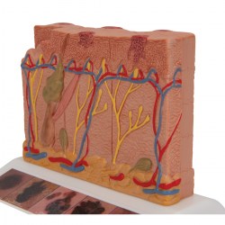 J15_07_1200_1200_Модель-рака-кожи-3B-Smart-Anatomy