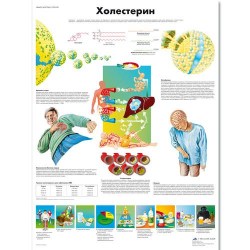 VR6452L_01_Медицинский-плакат-Холестерин