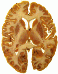 cns-91